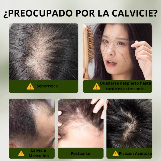 SHAMPOO EN BARRA CON Romero 2x1 - DOBLE ACCIÓN: CRECE&FORTALECE-OLVIDATE DE LA CAIDA DEL CABELLO+ENVÍO GRATIS 🎁
